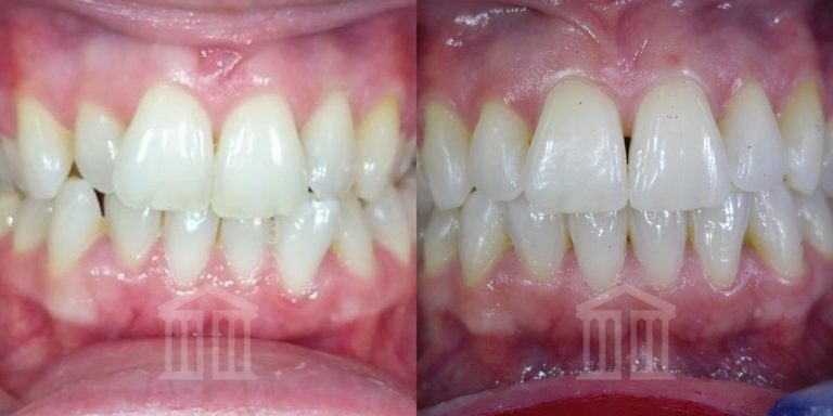 iTero scanning in Nottingham