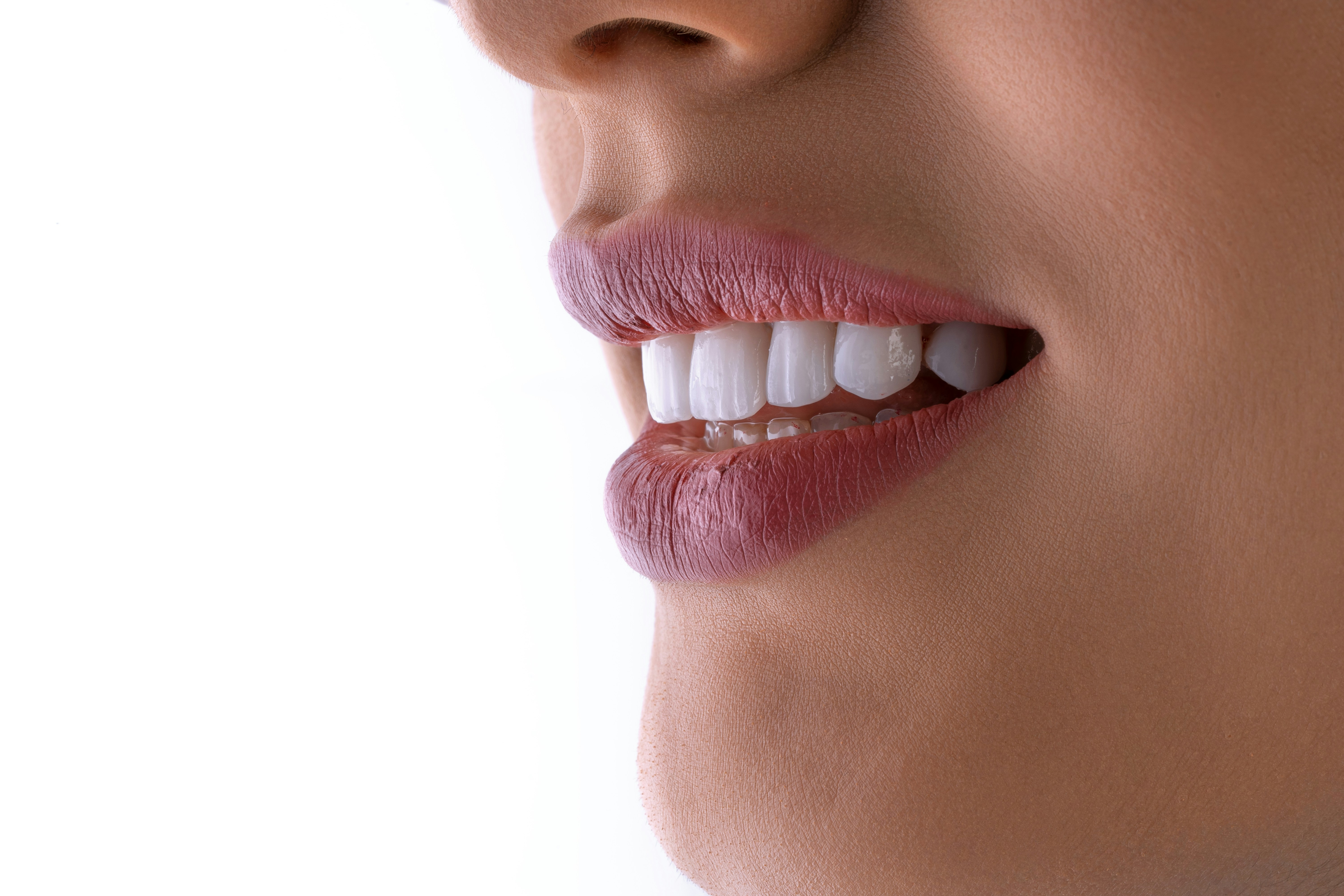 Close-up of a woman's smile with white teeth and mauve lips, showing a clear scale and polish result