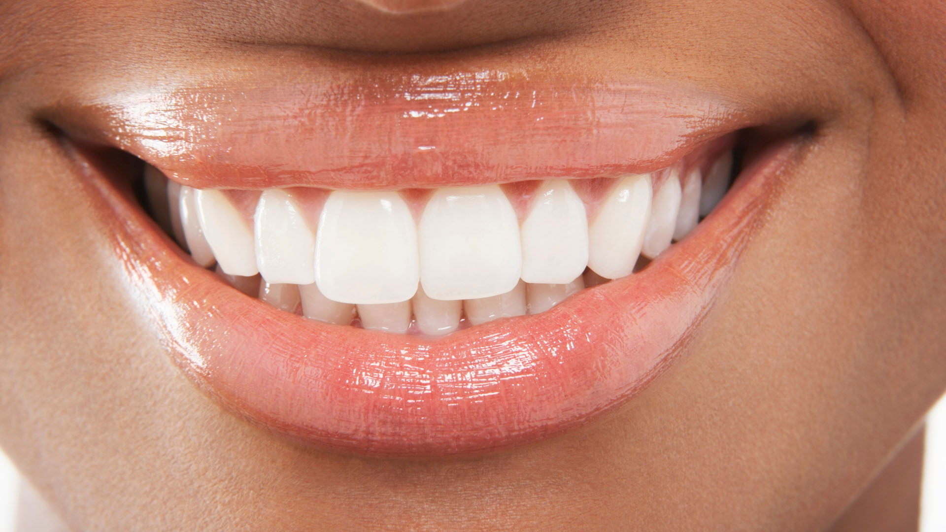 Close-up of a woman's smile showing bright white, evenly spaced teeth with no visible gaps