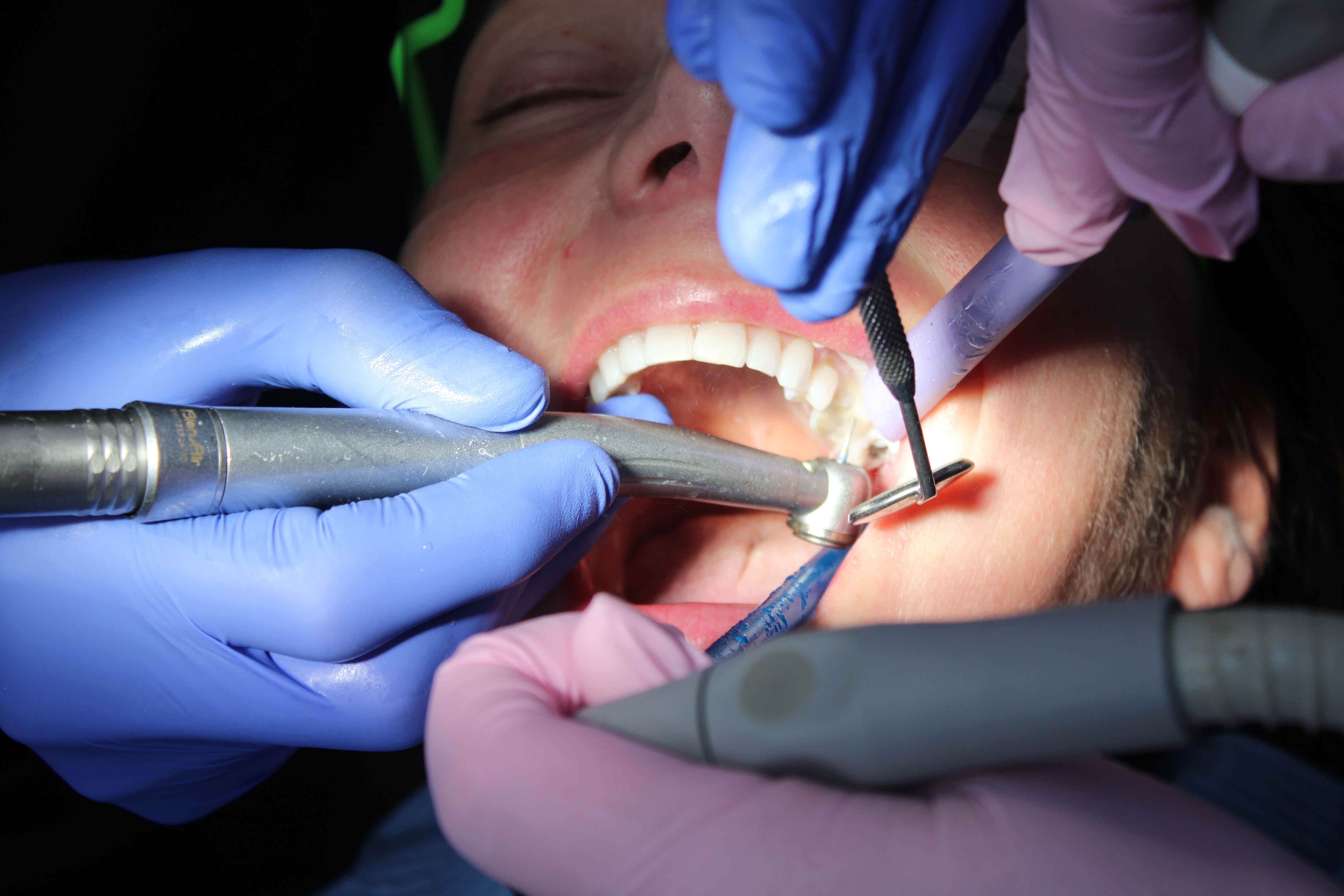 Dentist using a drill and mirror tool inside a patient's open mouth during a dental treatment procedure