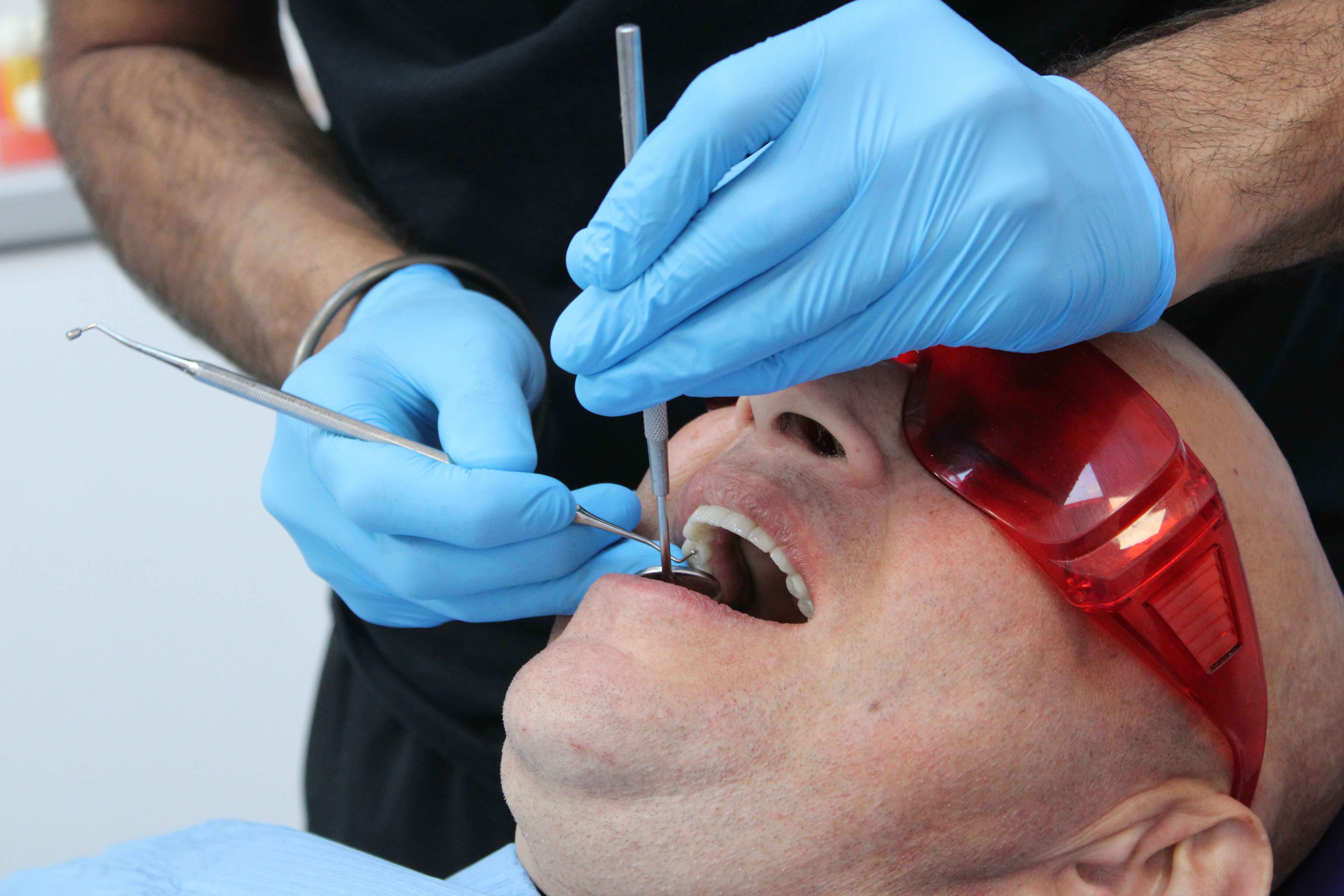 Dentist in blue gloves using dental tools to examine a male patient wearing red protective glasses