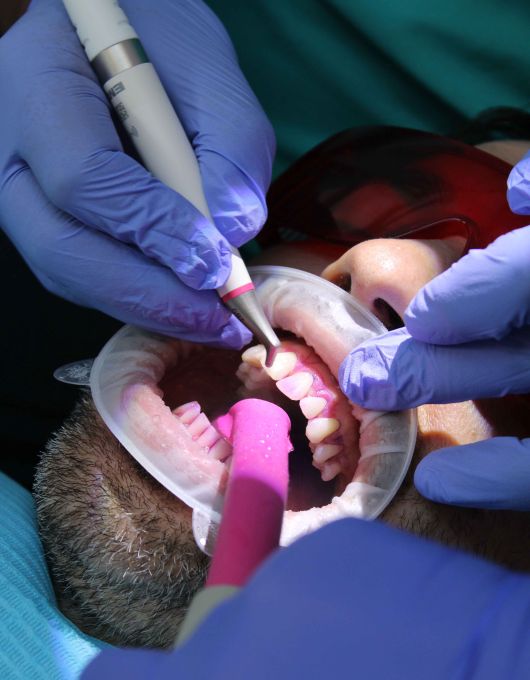Dentist in blue gloves using a dental tool inside a patient's open mouth held with a plastic retractor