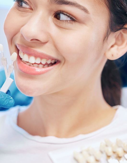 Smiling woman in a dental chair as a gloved dentist holds a tooth shade guide against her teeth