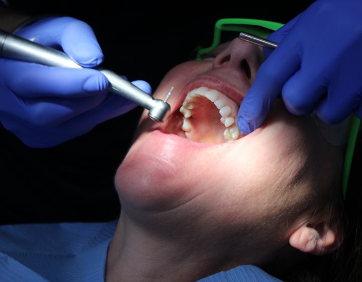 What to Do If You Have a Toothache: Causes, Relief, and When to See a Dentist