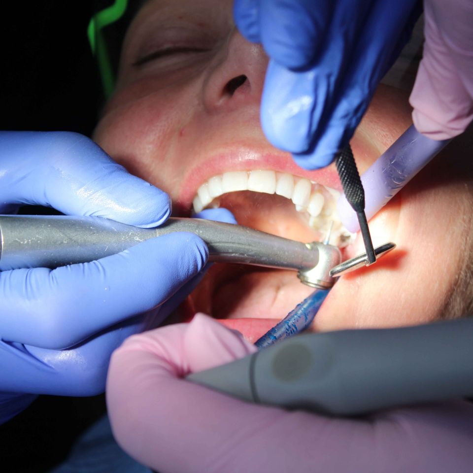 Dentist using a drill and mirror tool inside a patient's open mouth during a dental treatment procedure