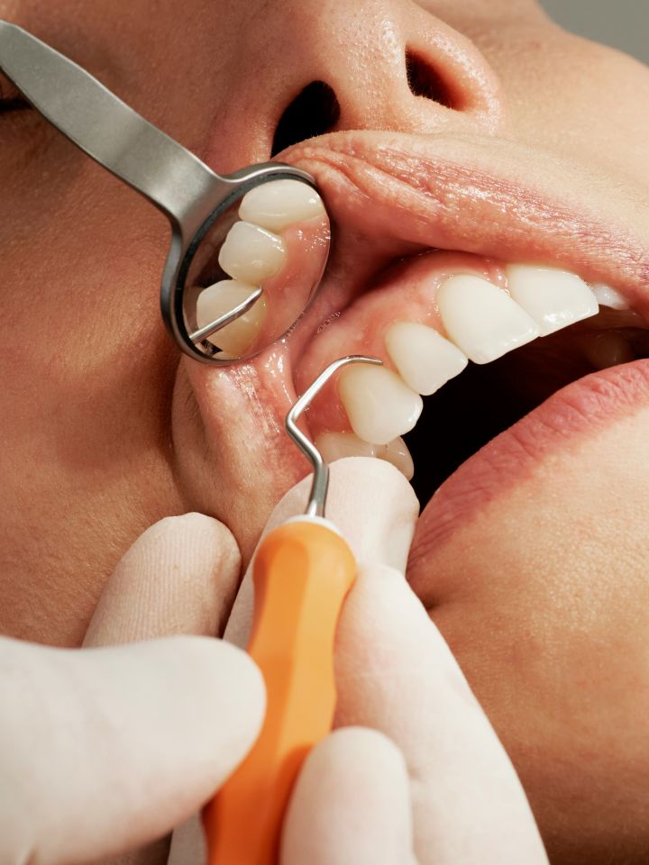 A dentist examining a patient's teeth using a mouth mirror and dental probe during a check up.