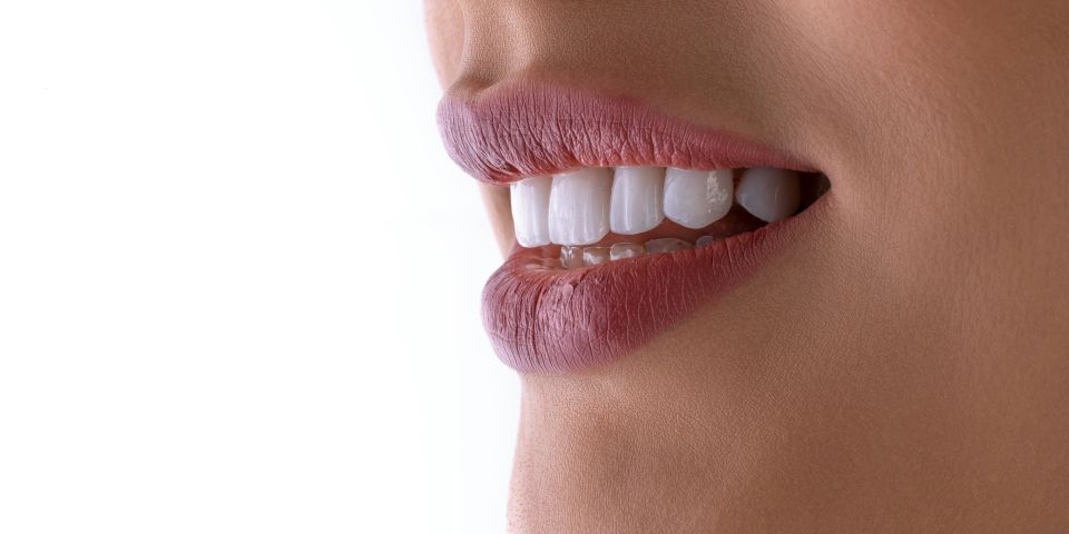 Close-up of a woman's smile with white teeth and mauve lips, showing a clear scale and polish result