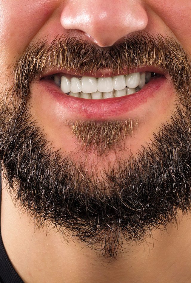 Teeth Grinding Zenith Cosmetic Dentistry