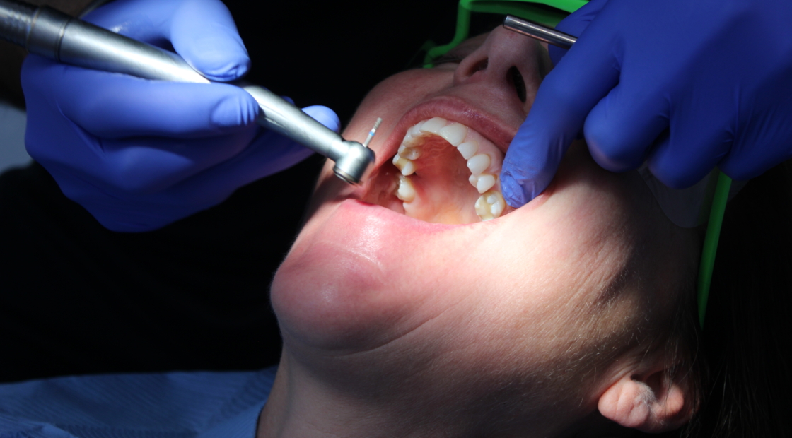 What to Do If You Have a Toothache: Causes, Relief, and When to See a Dentist