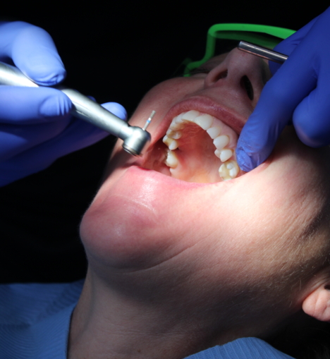 What to Do If You Have a Toothache: Causes, Relief, and When to See a Dentist
