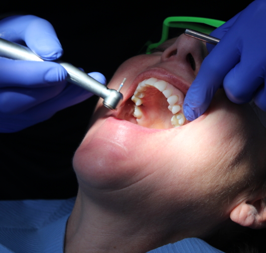 What to Do If You Have a Toothache: Causes, Relief, and When to See a Dentist